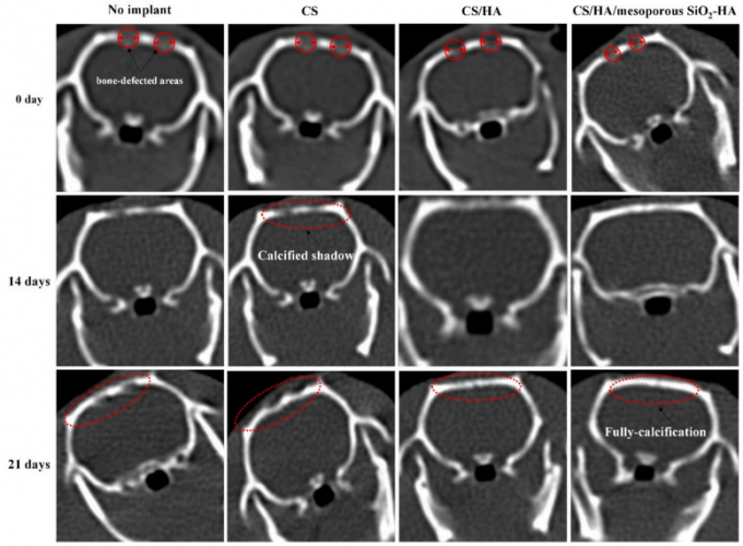 توسعه داربست‌های سه‌بعدی هیدروکسی آپاتیت-کیتوسان برای درمان و جایگزینی استخوان
